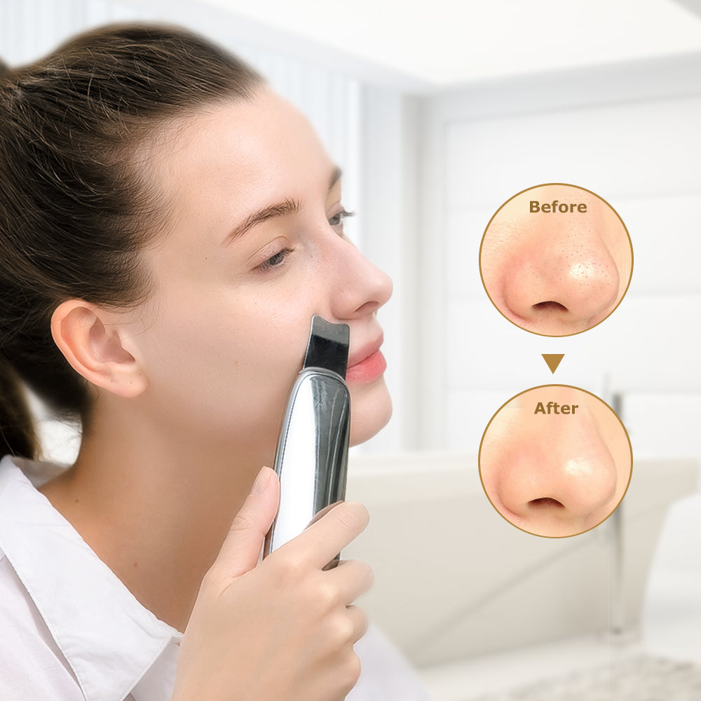 超聲波美容儀Ultrasonic Scrub Device – TOUCHBeauty HongKong