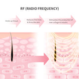 纖體去紋按摩儀 RF Body Massager