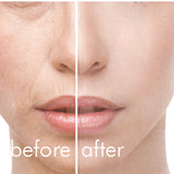 冷暖導入儀 Hot/Cool Skin Device