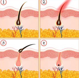 藍寶石冰點無痛脫毛機SAPPHIRE IPL HAIR REMOVAL DEVICE